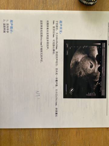 journal_insert_pic_1677289609