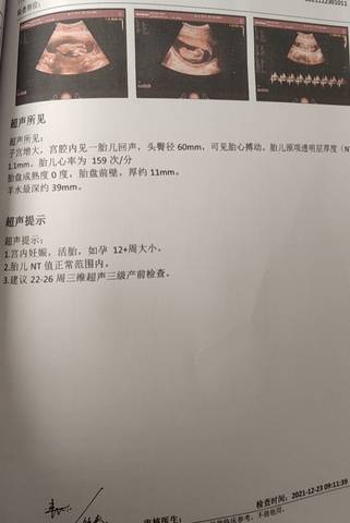 journal_insert_pic_1684616072