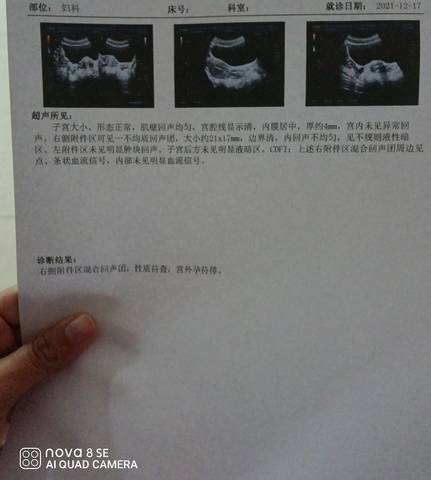 journal_insert_pic_1681628906
