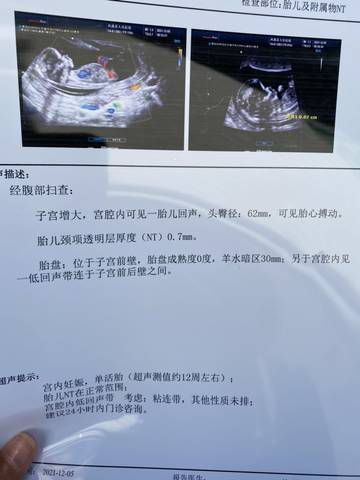 journal_insert_pic_1673995353
