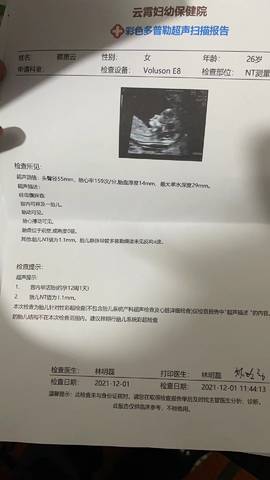 journal_insert_pic_1674325210