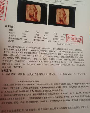 journal_insert_pic_1689389442
