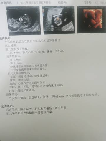 journal_insert_pic_1678178847