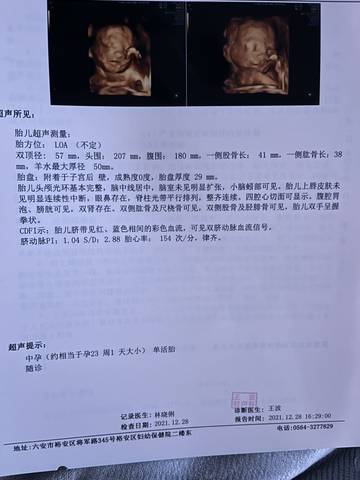 journal_insert_pic_1688165913