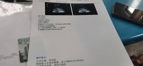 journal_insert_pic_1682173242
