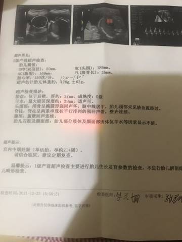 journal_insert_pic_1684832996