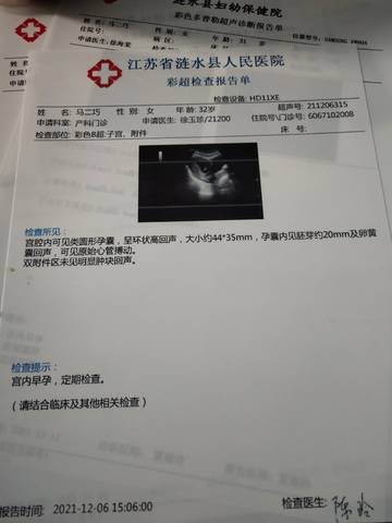 journal_insert_pic_1674880123