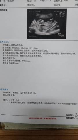 journal_insert_pic_1674658422