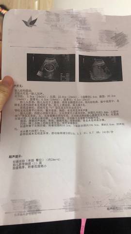 journal_insert_pic_1673092164