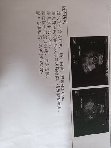 journal_insert_pic_1719416809