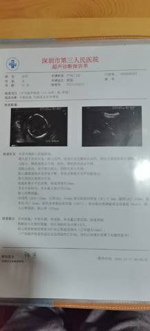 journal_insert_pic_1681608500