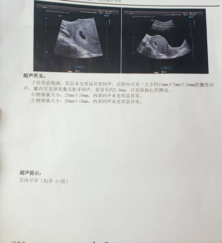 journal_insert_pic_1674040147