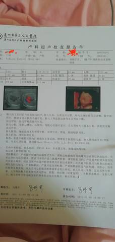 journal_insert_pic_1680993467