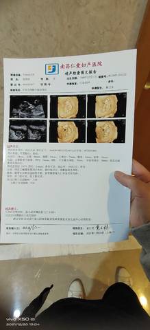 journal_insert_pic_1683028338