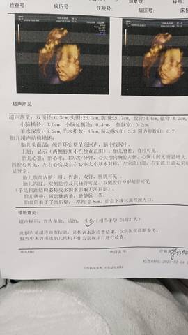 journal_insert_pic_1682119314