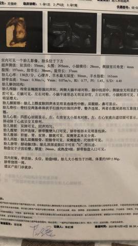 journal_insert_pic_1678032316
