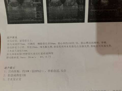 journal_insert_pic_1677260414