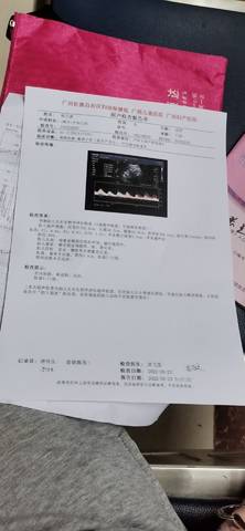 journal_insert_pic_1740925804