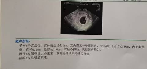 journal_insert_pic_1681611433