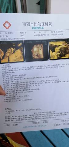 journal_insert_pic_1681189423