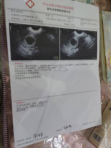 journal_insert_pic_1688280541