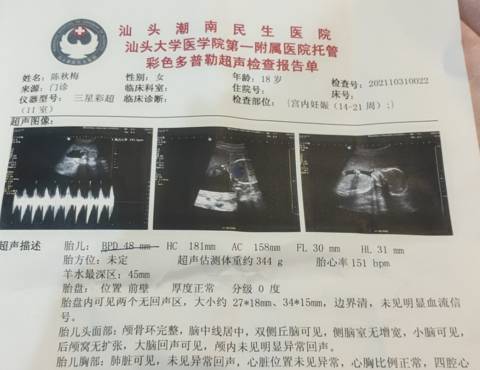 journal_insert_pic_1683221575