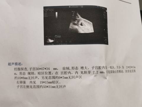 journal_insert_pic_1673042039