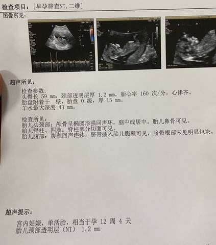 journal_insert_pic_1683460946