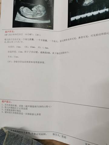 journal_insert_pic_1679966283