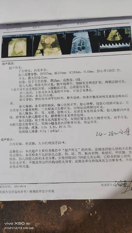 journal_insert_pic_1678927353