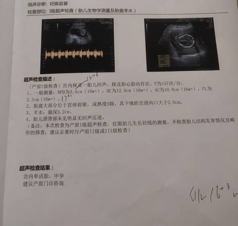 journal_insert_pic_1688865318
