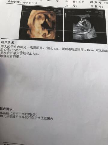 journal_insert_pic_1673343593