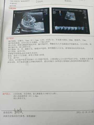journal_insert_pic_1682567610