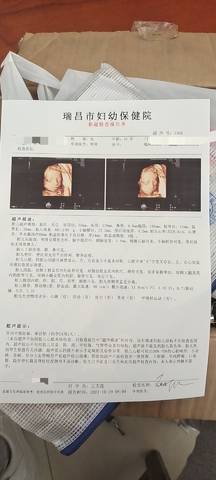 journal_insert_pic_1678560072
