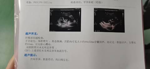 journal_insert_pic_1682406486