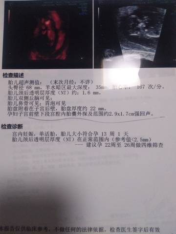 journal_insert_pic_1680161507