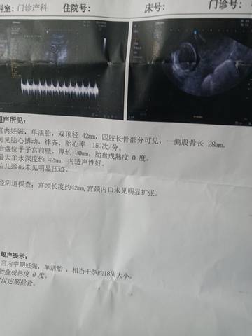 journal_insert_pic_1677215544