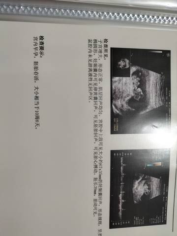 journal_insert_pic_1675142023