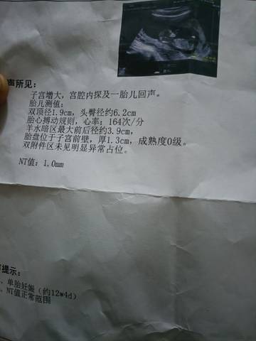 journal_insert_pic_1678664513