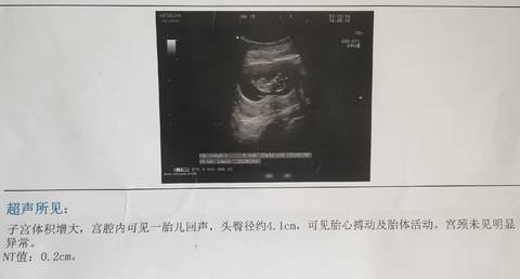 journal_insert_pic_1688165710