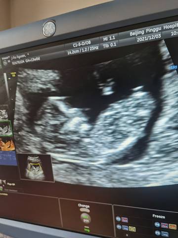 journal_insert_pic_1681810092