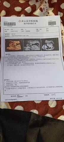 journal_insert_pic_1741000040