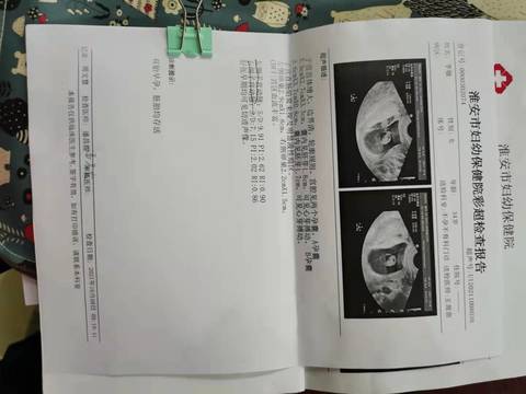 journal_insert_pic_1677466032
