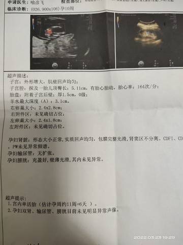 journal_insert_pic_1741111473