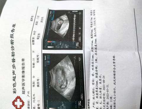 journal_insert_pic_1675232239