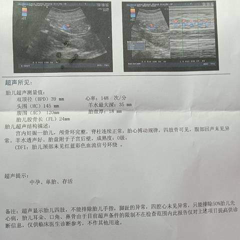 journal_insert_pic_1681546891