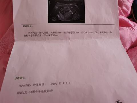 journal_insert_pic_1689015360