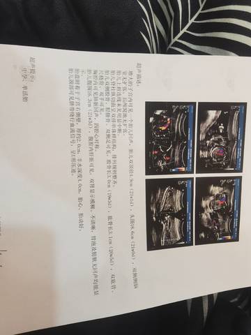 journal_insert_pic_1678036681