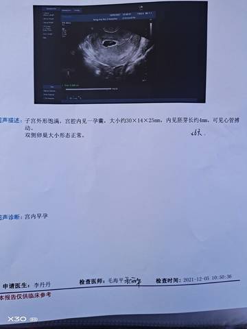 journal_insert_pic_1674078890