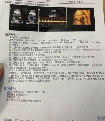 journal_insert_pic_1681695821